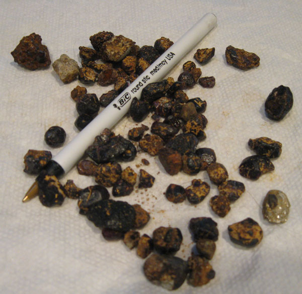 Idaho Star Garnet Collecting